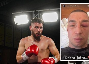 Jakaj e lë me pasoja boksierin serb, Nikoliq zgjohet me njërin sy të ënjtur