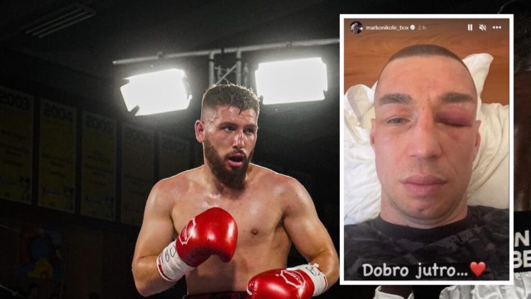 Jakaj e lë me pasoja boksierin serb, Nikoliq zgjohet me njërin sy të ënjtur