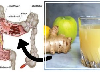 Kapslleku, fryrje e barkut dhe gazrat; kjo është receta qe ju pastron më shpejt se ilaçet..!?