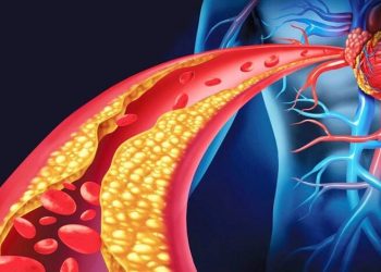 Pesë ushqime që ndihmojnë në uljen e kolesterolit