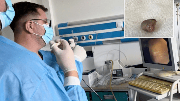 64-vjeçarit i shpëtohet jeta në QKUK, mjekët ia largojnë copën e mishit të mbetur në fyt (Kujdes+18)