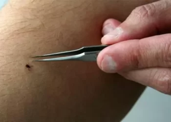 Mbi 700 pickime të rriqrave në Malishevë, 3 persona janë dërguar në QKUK