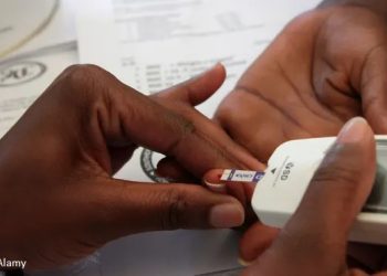 Diabeti mbetet i padiagnostikuar në 40 % të rasteve në botë