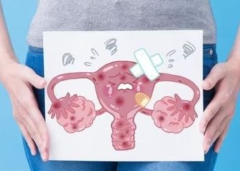 Cilat janë simptomat e kancerit të vezoreve?