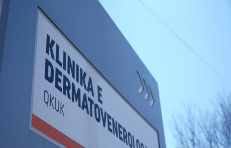 ​Mbi 16 mijë vizita në Klinikën e Dermatologjisë vetëm brenda nëntë muajve