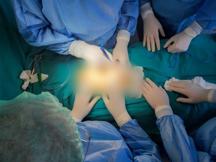 811 raste të thyerjes së gurëve në veshkë për nëntë muaj në QKUK