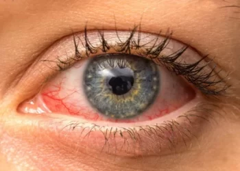 Problemet që shkakton celulari, si të kujdeseni për tharjen e syve