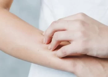 Si të mbroheni prej alergjisë nga dielli?