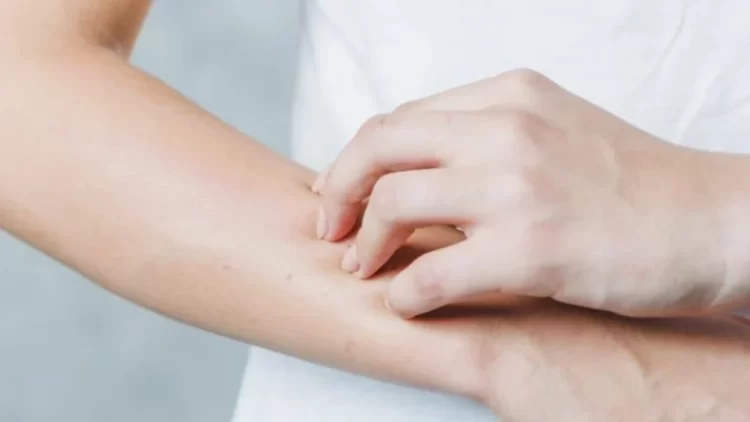 Si të mbroheni prej alergjisë nga dielli?