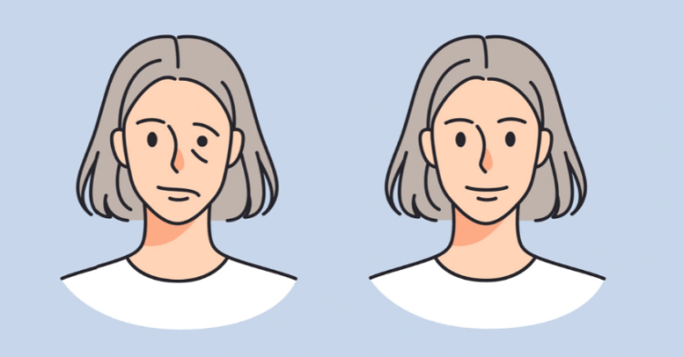 P*raliza e fytyrës, cilat janë shkaqet dhe si trajtohet?