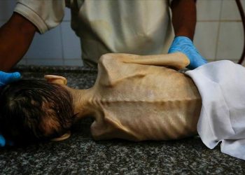 Një tjetër fëmijë vdes nga uria në Gaza