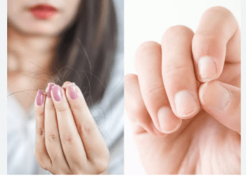 Cilat janë simptomat që ju tregojnë se trupit tuaj i mungojnë proteinat