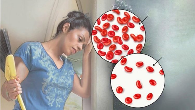 Shkaktarët e anemisë