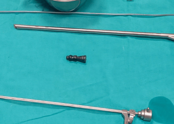 11-vjeçarit i hiqet një figurë e shahut nga rrugët e frymëmarrjes në QKUK