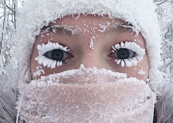 Pse na dobësohet shikimi kur bie borë?