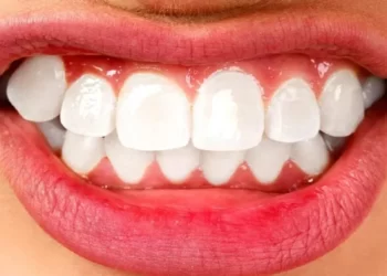 A e dini se çfarë ndodh në trupin tuaj kur kërcisni dhëmbët?