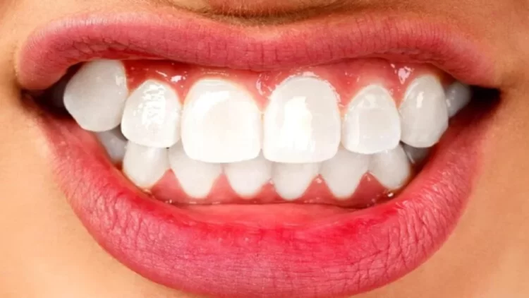 A e dini se çfarë ndodh në trupin tuaj kur kërcisni dhëmbët?