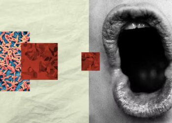 Disa baktere në gojë mund të shkaktojnë demencë