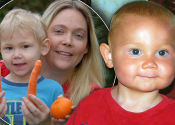 Karotat dhe ngjyra portokalli e lëkurës te bebet