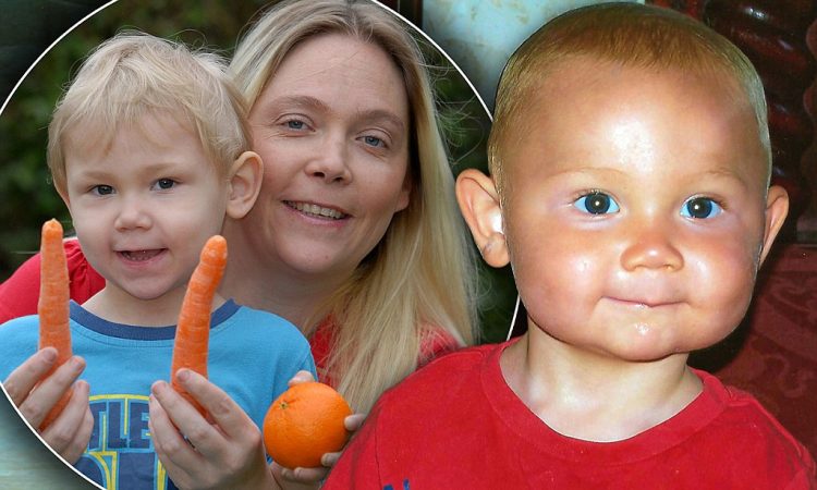 Karotat dhe ngjyra portokalli e lëkurës te bebet