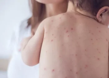 Rriten rastet me fruth në Kosovë