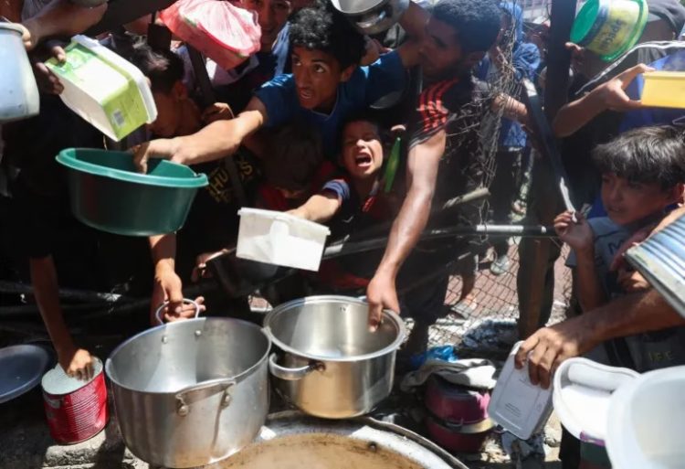 Shumica e pacientëve të shtruar në spitalet e Gazës janë aty për shkak të kequshqyerjes