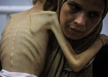 Lajm i fundit: Lajm i tmerrshëm nga Palestina! Situata është bërë katastrofike… GAZA PO VDES NGA ‘URIA’