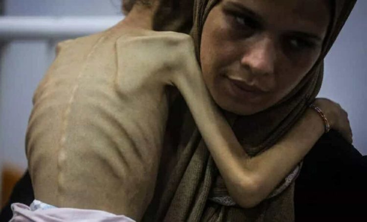 Lajm i fundit: Lajm i tmerrshëm nga Palestina! Situata është bërë katastrofike… GAZA PO VDES NGA ‘URIA’