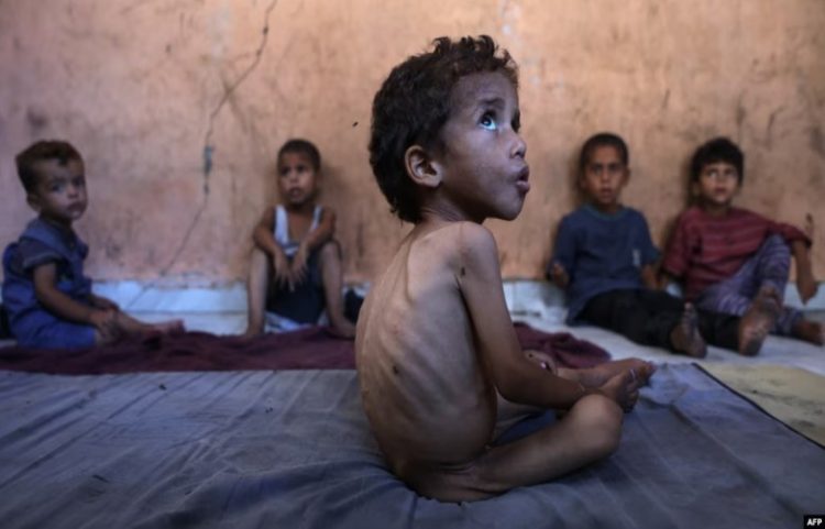 Amnesty akuzon Izraelin se qëllimshëm po shkakton uri në Gazë