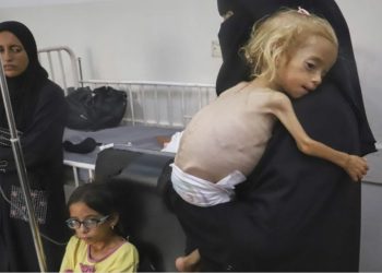 11 palestinezë të tjerë vdesin nga uria në Gaza, numri total arrin në 300