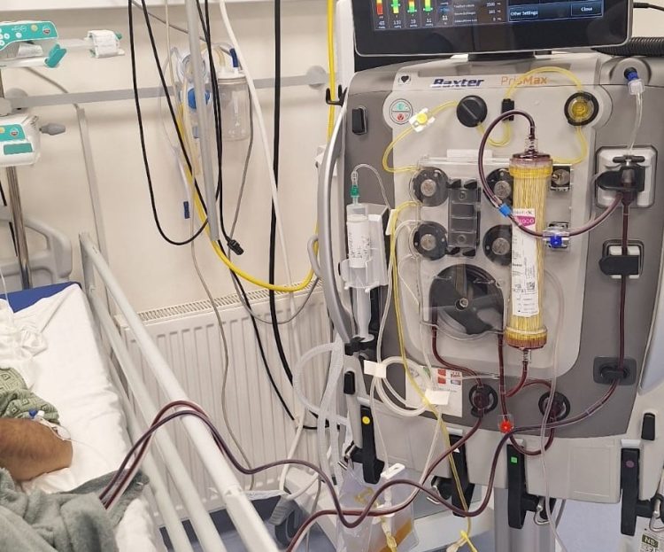 Në Klinikën e Hematologjisë trajtohet me sukses një rast i rrallë dhe kërcënues për jetën