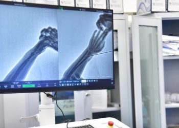 Vitia tregon se janë siguruar katër pajisje në vlerës gjysmë milioni euro për QKUK-në dhe dy spitale rajonale
