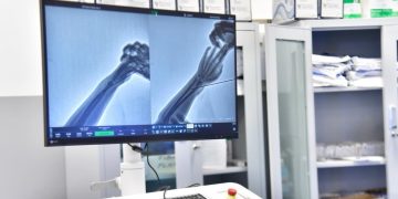 Vitia tregon se janë siguruar katër pajisje në vlerës gjysmë milioni euro për QKUK-në dhe dy spitale rajonale