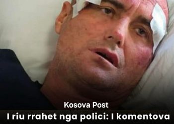 I riu rr@het nga polici / “I komentova motrës së tij në Facebook”: Je bërë shumë e bukur