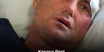 I riu rr@het nga polici / “I komentova motrës së tij në Facebook”: Je bërë shumë e bukur