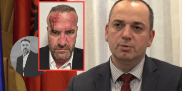 “Akt qyqar, kur s’kanë argumente, përdorin grushtet” – Haskuka reagon ashpër pas sulmit ndaj Mehanit