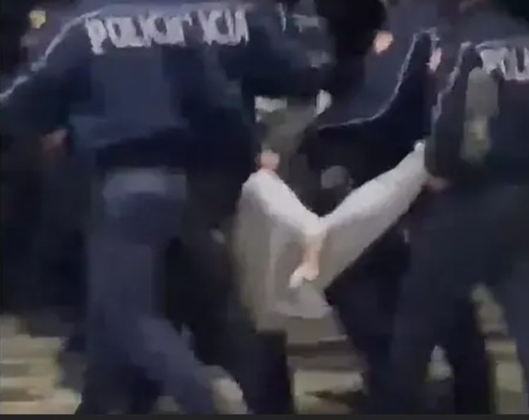 Pamjet trishtuese nga protesta në Tiranë, pezullohen policët që e bartnin për gjymtyrë një protestues me këmbë të thýer